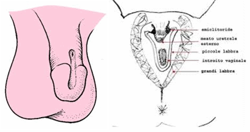 epispadia - malformazione genitali maschili e femminili